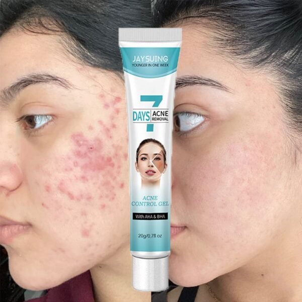 Crema tratamiento acne mascarilla facial FK23B-39 - Imagen 3