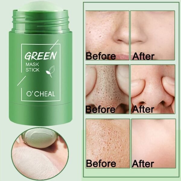 Mascarilla facial Meidian de rodillo para piel SP-2