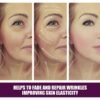 Parche facial antiarrugas SP-3 - Imagen 4